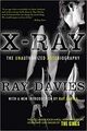 Omslagsbilde:X-Ray : the unauthorized autobiography